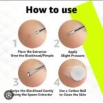 vega blackheads remover for effortless grooming